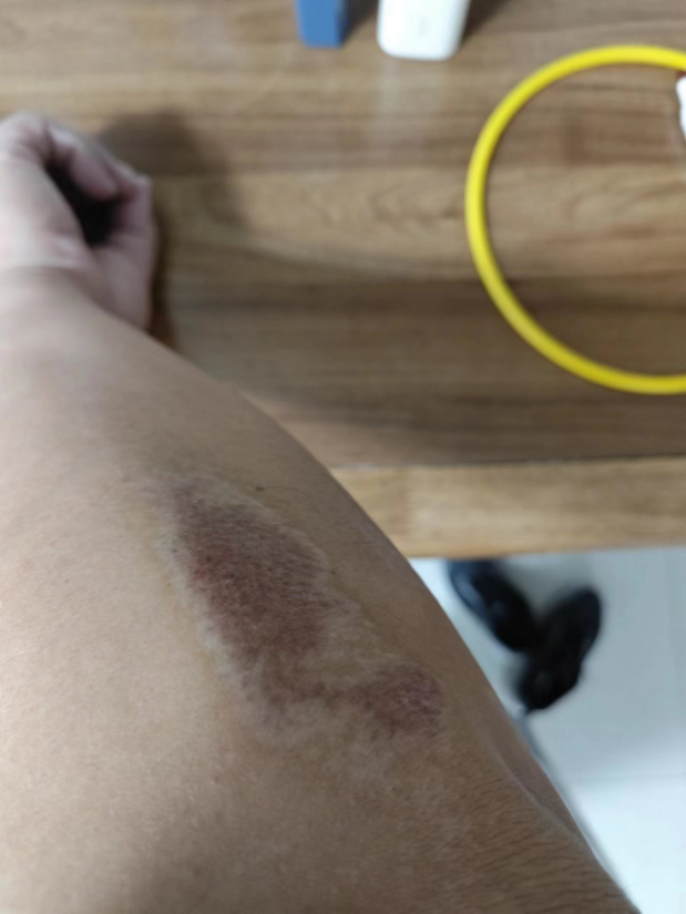 【感動故事匯】那一刻，他們用行動寫出了答案......